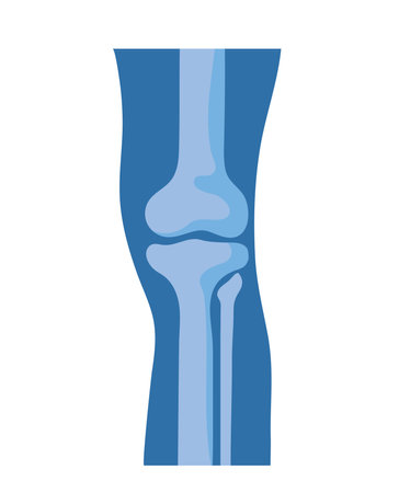 normal knee bones and jointsのイラスト素材