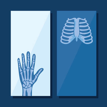 rheumatology posters set with bonesのイラスト素材
