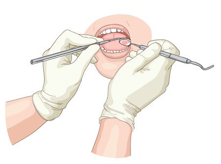 Treatment at the stomatologist   illustration のイラスト素材