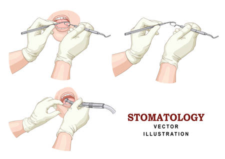 Stomatology vector set.のイラスト素材