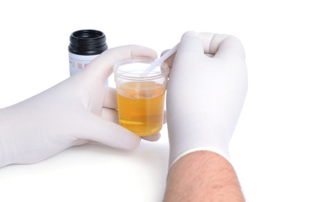 The laboratory assistant investigates urine from test strips. Isolated.
