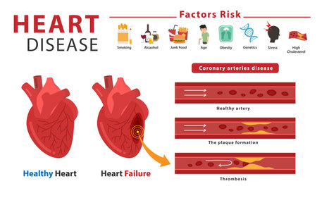 Medical infograpic of heart attacks and Human heart with Coronary Artery Disease.のイラスト素材
