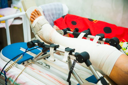 The hospital provides qualified assistance and care for patients with bandaged legsの写真素材