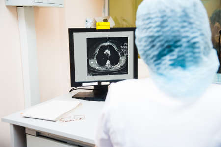 Laboratory of Medical research. Screen showing the results of the patient's MRI scanの写真素材