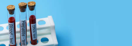 Blood test Hepatitis Test and DNA Test in Vitro. The concept of Medicine and Analysis, human Health. Place under the text.の写真素材