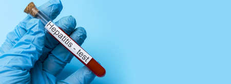 Hepatitis test, Blood in the test Tube. The concept of Medicine and Analysis. Place under the text.の写真素材