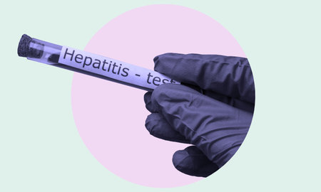 Art collage, a hand in a medical glove holding a blood test tube for hepatitis. The concept of medical tests for human health.の写真素材