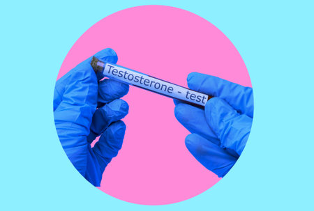 Art collage, gloved hands with a blood test tube for a testosterone test. The Concept of Tests and Tests in Medicine.の写真素材