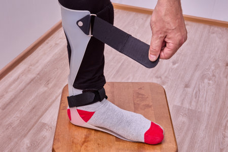 Foot orthosis ankle and leg support for foot drop.の写真素材