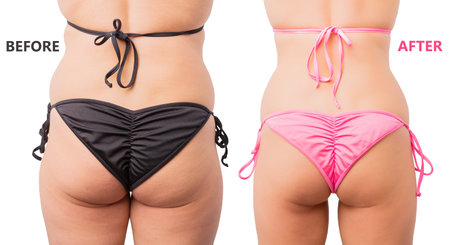 Before and after weight loss comparison