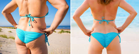 Woman in bikini from back before and after weight lossの写真素材