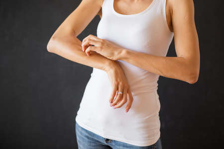Woman with skin eczema problemの写真素材
