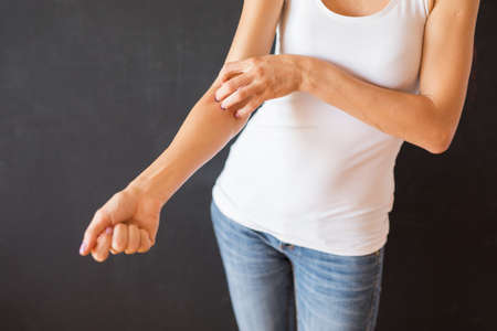 Skin eczema problemの写真素材