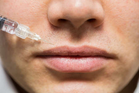 Man getting lips enhancement therapyの写真素材