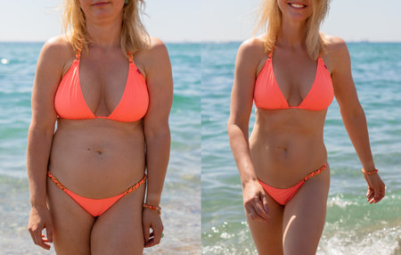 Candid photos of a woman before and after weight lossの写真素材