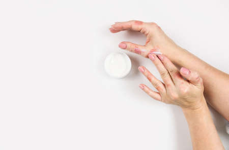 A woman applies cream to her hands to treat dermatitis. Skin diseases. Close-up. Flat lay.の写真素材