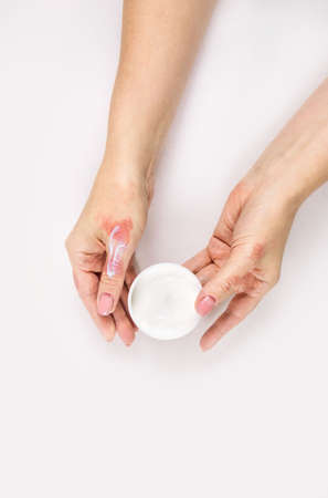 Cream for the treatment of dermatitis. Female hands, close-up. Flat lay.の写真素材