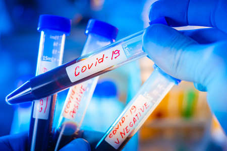 Mass screening of patients for coronavirus. Test tubes with positive and negative tests for Covid-19. Laboratory tests for coronavirus. Detection Of Covid-19.の写真素材