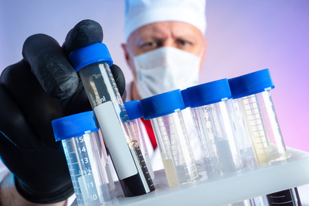 Blood test. Hematological concept. The doctor is holding test tubes of blood. Laboratory...