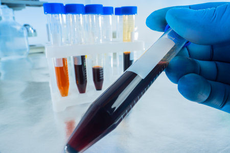 Lab technician hands next to the test tubes. Samples of chemicals in test tubes. Research of product...