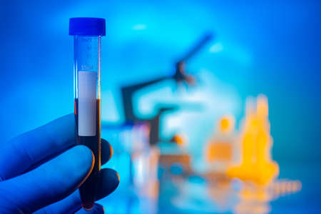 Blood test tubes with a place for inscription. Laboratory assistant hand. Doctor in a medical glove holds blood. Concept - blood test. Test for virus. Blurred laboratory in background.の写真素材