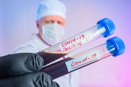 Covid-19. Coronavirus. Doctor shows test tubes. Chowid inscription on plastic test tubes. Samples of...