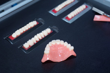 Dental plate on a black background. Several dentures in a black case. Storage case for dentures. Concept - work as an orthodontist. Dentures made by an orthodontist. Visual equipment in artodonticsの写真素材