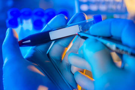 Test tube with blood in hand. Hands write something on a test tube. Medical plastic flask with blood. Concept - doctor writes diagnosis. Doctor signs analysis in flask. Doctor doing blood testの写真素材
