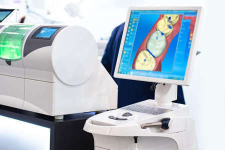 Modern technologies in dental industry. Digital dentistry concept. Digital scan of human teeth. Result is displayed on a blue screen. Equipment for dentistry. Prosthetics at dental industryの写真素材