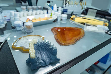 Prosthetist work table. Denture manufacturing process. Orthodontist dentist desk. Unfinished denture. Nearby are dental instruments and materials for production of crowns. Dental crowns.の写真素材