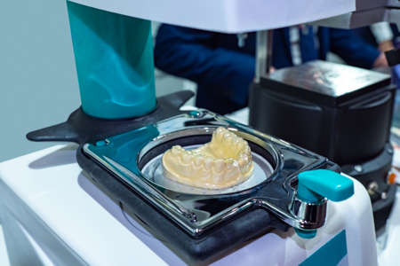 Implantation. Process of manufacturing dental implants. Concept - artificial teeth. Workshop of orthodontists. dentures from acetal. Orthopedic dentistry. Concept - Department of Orthopedic Dentistryの写真素材