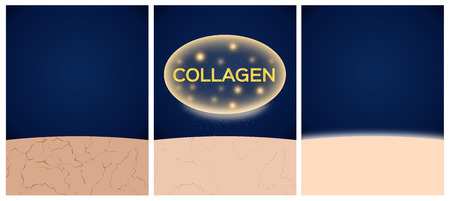 collagen and skin before and afterのイラスト素材