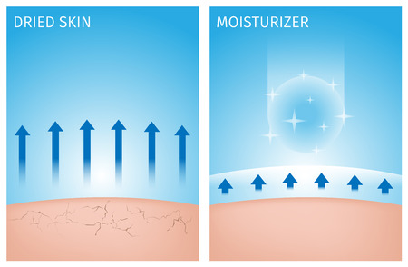 dried skin and skin with moisturizer , before and afterのイラスト素材