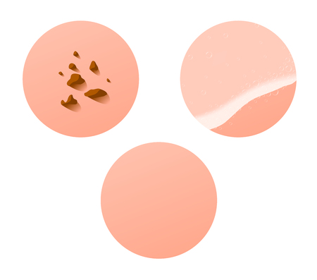Dirty skin , Cleaning skin , Normal skinのイラスト素材