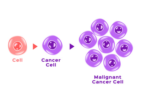 cancer cell in human body . anatomyのイラスト素材