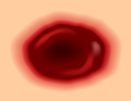 wound skin vector graphic . blood come out of woundのイラスト素材