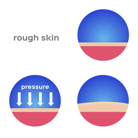 rough skin and callus vectorのイラスト素材