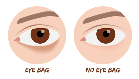 eye bag vectorのイラスト素材