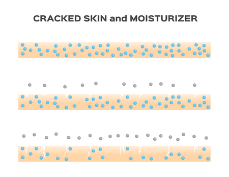 moisturizer lose . aging skin vectorのイラスト素材