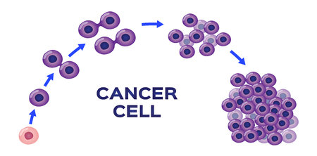 cancer cell stage and development vectorのイラスト素材