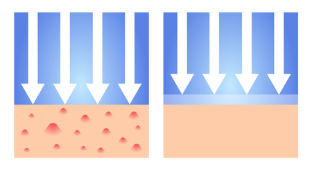 irritate , eczema and allergy skin protection . vectorのイラスト素材