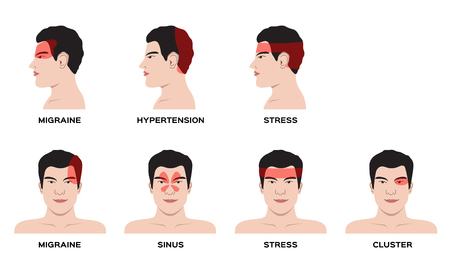 An headache type vector  for organ and anatomy conceptのイラスト素材