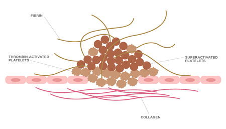 platelet and fibrin on wound vectorのイラスト素材