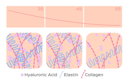 aging skin level vector / hyaluronic acid / elastin / collagenのイラスト素材