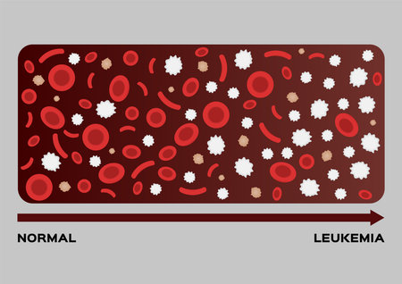 leukaemia / human blood concept / white and red blood cell vector