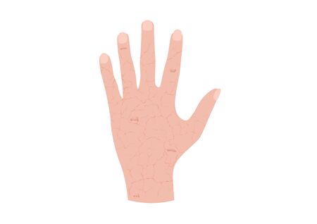 hand and dry skin vector / agingのイラスト素材