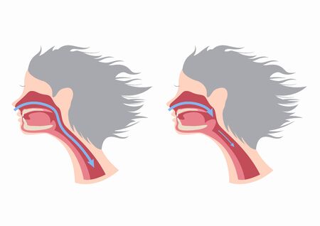 a snoring infographic, vector, human anatomyのイラスト素材