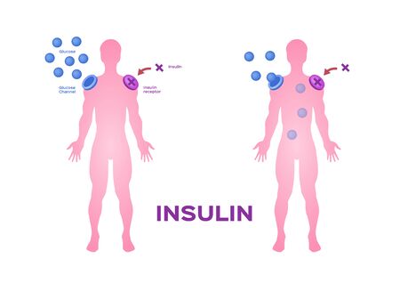 Insulin unlocks the cell's glucose channel vector / pancreas and blood vesselのイラスト素材