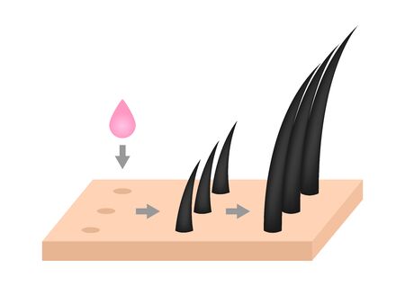 hair growth serum vectorのイラスト素材