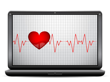 Heart beat on the display. Vector illustration.のイラスト素材